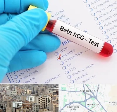 آزمایشگاه بارداری در جنوب شرق تهران