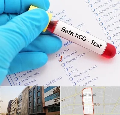 آزمایشگاه بارداری در نجات اللهی