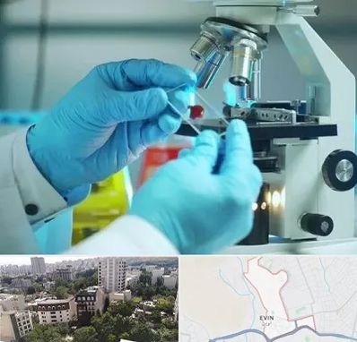 آزمایشگاه با جواب فوری در اوین