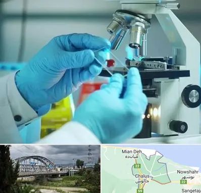 آزمایشگاه با جواب فوری در چالوس