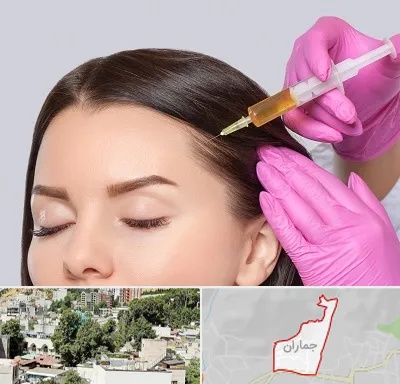 تزریق هیر فیلر در جماران