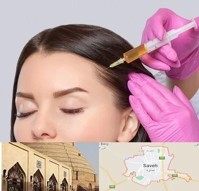 تزریق هیر فیلر در ساوه