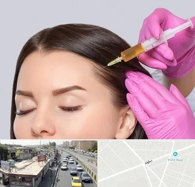 تزریق هیر فیلر در خیابان دماوند