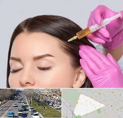 تزریق هیر فیلر در احمدآباد مشهد 