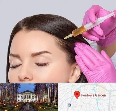 تزریق هیر فیلر در باغ فردوس