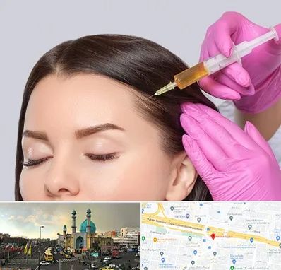 تزریق هیر فیلر در رسالت 