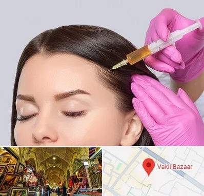 تزریق هیر فیلر در بازار وکیل شیراز