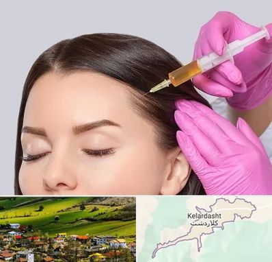 تزریق هیر فیلر در کلاردشت