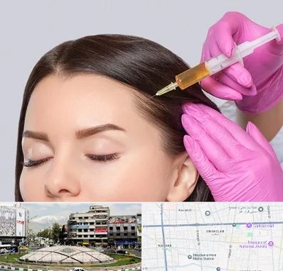 تزریق هیر فیلر در مرکز تهران