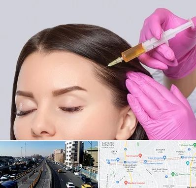 تزریق هیر فیلر در پیروزی 