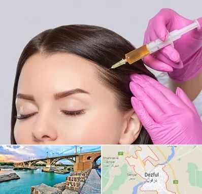 تزریق هیر فیلر در دزفول