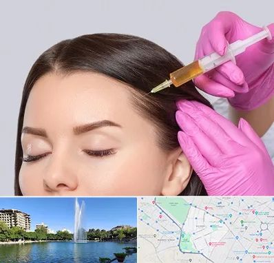 تزریق هیر فیلر در کوهسنگی مشهد