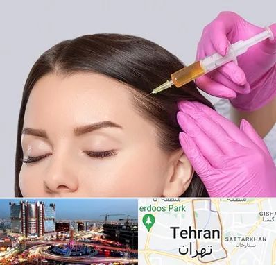 تزریق هیر فیلر در صادقیه 