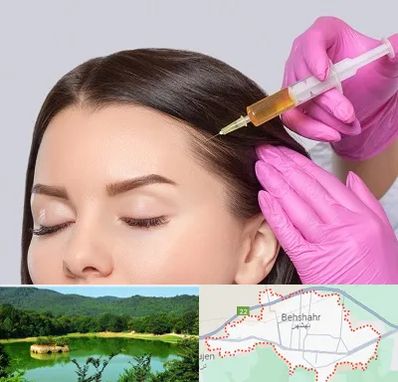 تزریق هیر فیلر در بهشهر