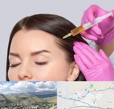 تزریق هیر فیلر در رودهن