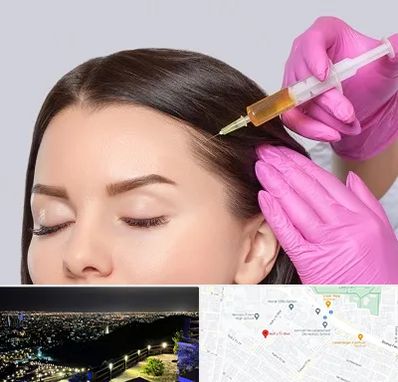 تزریق هیر فیلر در هفت تیر مشهد 