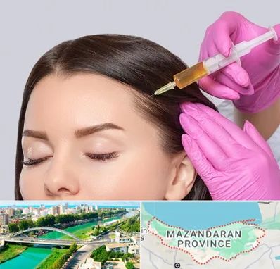 تزریق هیر فیلر در مازندران