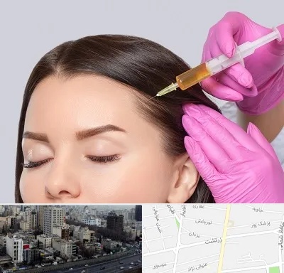 تزریق هیر فیلر در زرتشت