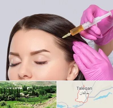 تزریق هیر فیلر در طالقان