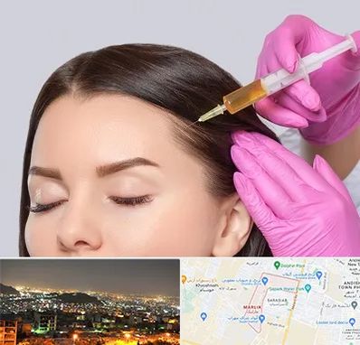 تزریق هیر فیلر در مارلیک کرج