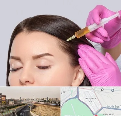 تزریق هیر فیلر در جوادیه