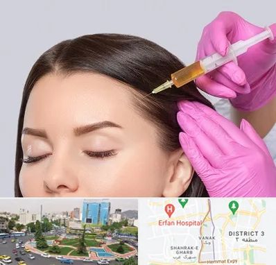 تزریق هیر فیلر در ونک 