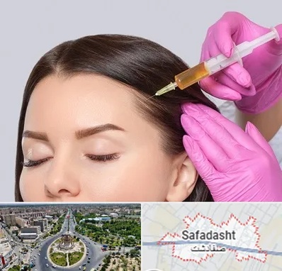تزریق هیر فیلر در صفادشت