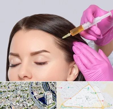 تزریق هیر فیلر در قاسم آباد مشهد 