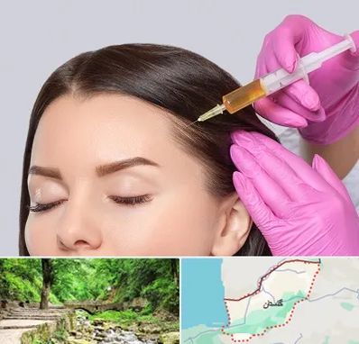 تزریق هیر فیلر در گلستان
