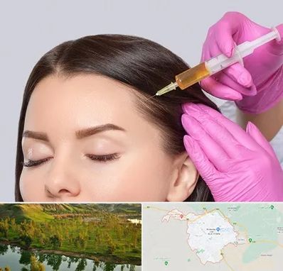 تزریق هیر فیلر در بهبهان