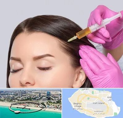 تزریق هیر فیلر در کیش