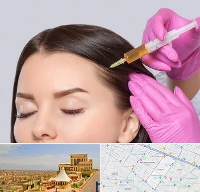 تزریق هیر فیلر در هاشمیه مشهد