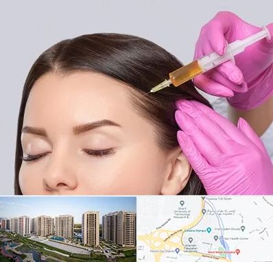 تزریق هیر فیلر در المپیک 