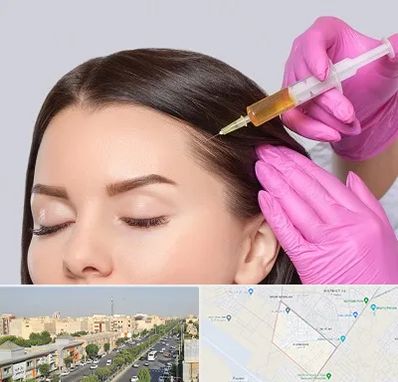 تزریق هیر فیلر در کیانمهر کرج