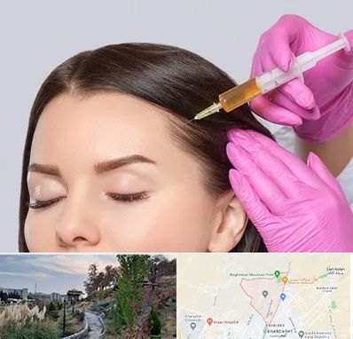 تزریق هیر فیلر در باغستان کرج