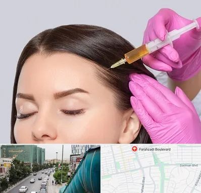 تزریق هیر فیلر در بلوار فرحزادی