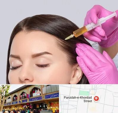 تزریق هیر فیلر در 15 خرداد