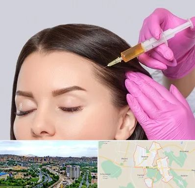 تزریق هیر فیلر در شهریار