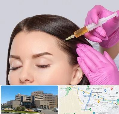 تزریق هیر فیلر در صیاد شیرازی مشهد