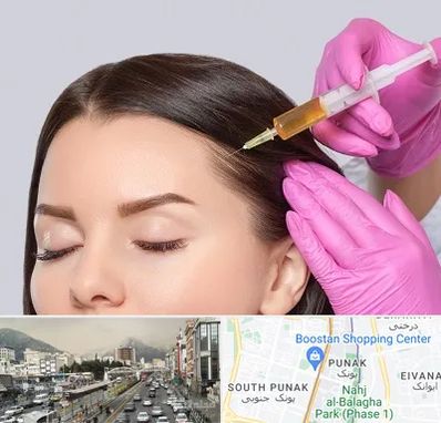 تزریق هیر فیلر در پونک 