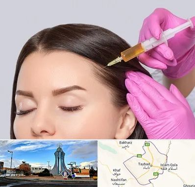 تزریق هیر فیلر در تایباد