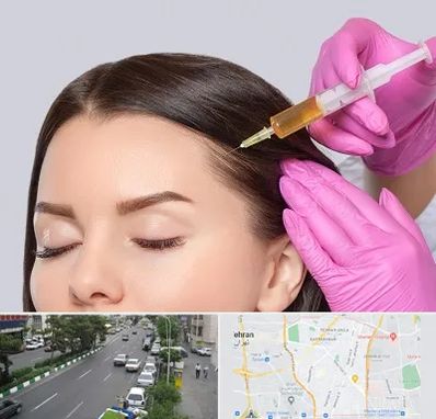 تزریق هیر فیلر در ستارخان 