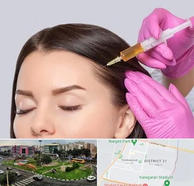 تزریق هیر فیلر در تهرانسر 