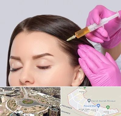 تزریق هیر فیلر در پرند