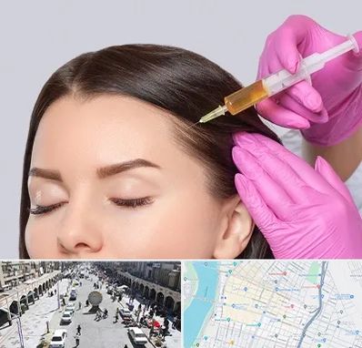 تزریق هیر فیلر در نادری اهواز