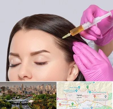 تزریق هیر فیلر در منطقه 1 تهران 