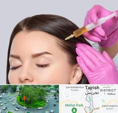 تزریق هیر فیلر در تجریش 