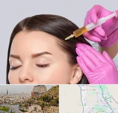 تزریق هیر فیلر در فرهنگ شهر شیراز