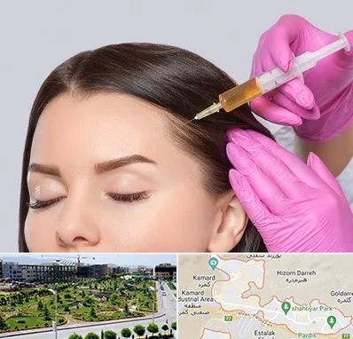 تزریق هیر فیلر در پردیس