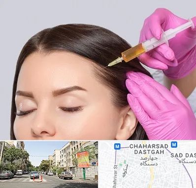 تزریق هیر فیلر در چهارصد دستگاه 